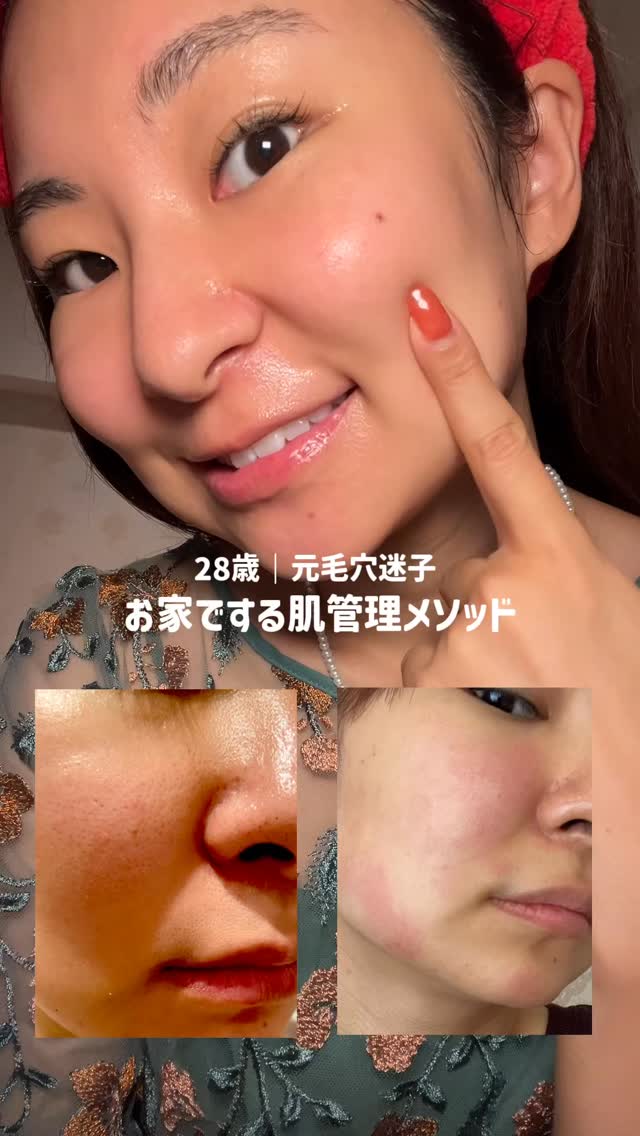 『ピカピカ』ってコメント& @lee.babyskin をフォローしてね🫧
フォローしてくれた方を優先サポートしてます🤍

今年こそ、本気で毛穴悩みを卒業しませんか🪄

⟡.· ⎯⎯⎯⎯⎯⎯⎯⎯⎯⎯⎯⎯ ⟡.·

美容迷子を卒業した、り〜ちゃんです🪽
おうちケアだけで
“毛穴レスなすっぴん赤ちゃん肌”
を目指す方法をシェアしています✨

✔︎ 毛穴の黒ずみ・開きが気になる
✔︎ ファンデで隠さずに過ごしたい
✔︎ 肌荒れのない自分に変わりたい

そんな方へ、あなたに合ったケアのサポートをしています💌

私が遠回りした経験が誰かの力になって
正しいスキンケアで、自分の肌をもっと好きになれますように🌸

⟡.· ⎯⎯⎯⎯⎯⎯⎯⎯⎯⎯⎯⎯ ⟡.·

#ベビスキン #毛穴ケア #毛穴レス #すっぴん肌 #おうち美容 #スキンケア迷子卒業 #nuskin #babyskin